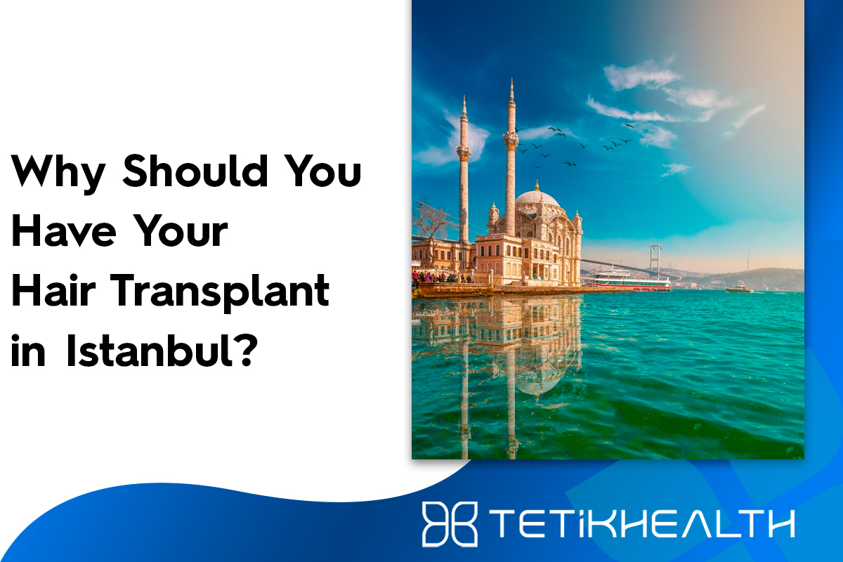 Why should you have your hair transplant in Istanbul?