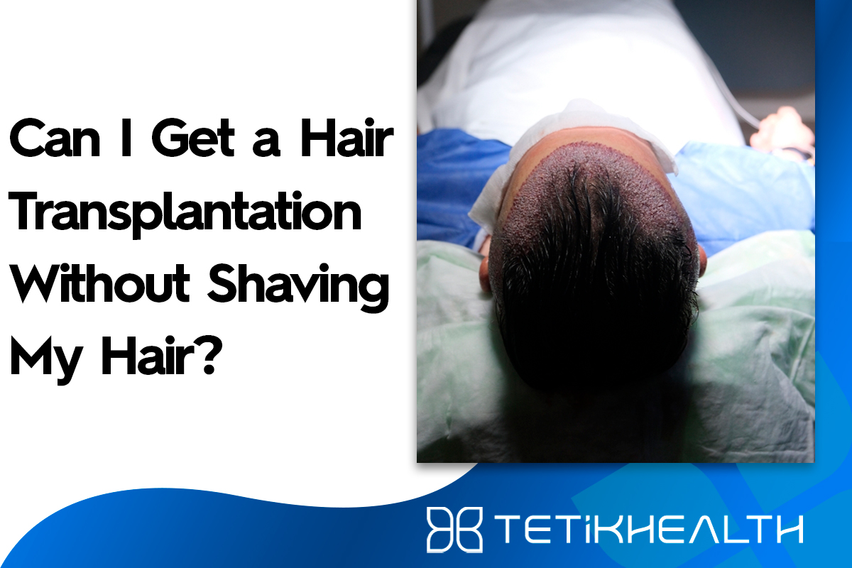 Can I Get a Hair Transplantation Without Shaving My Hair?
