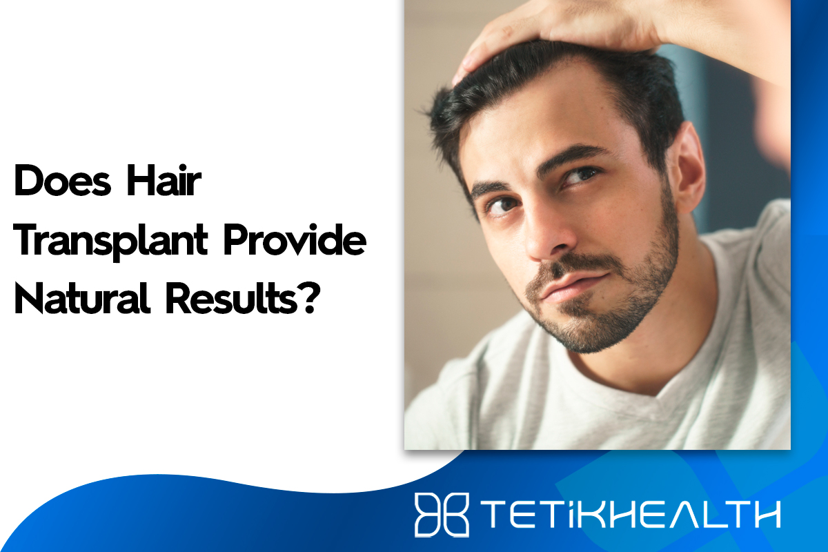 Does Hair Transplant Provide Natural Results?